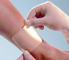 Emplastros para Tratamento de Doenças da Pele